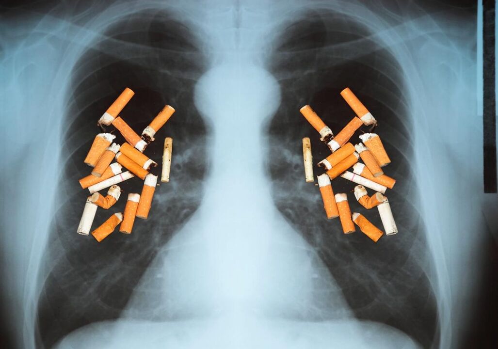Como afectan os cigarros aos pulmóns
